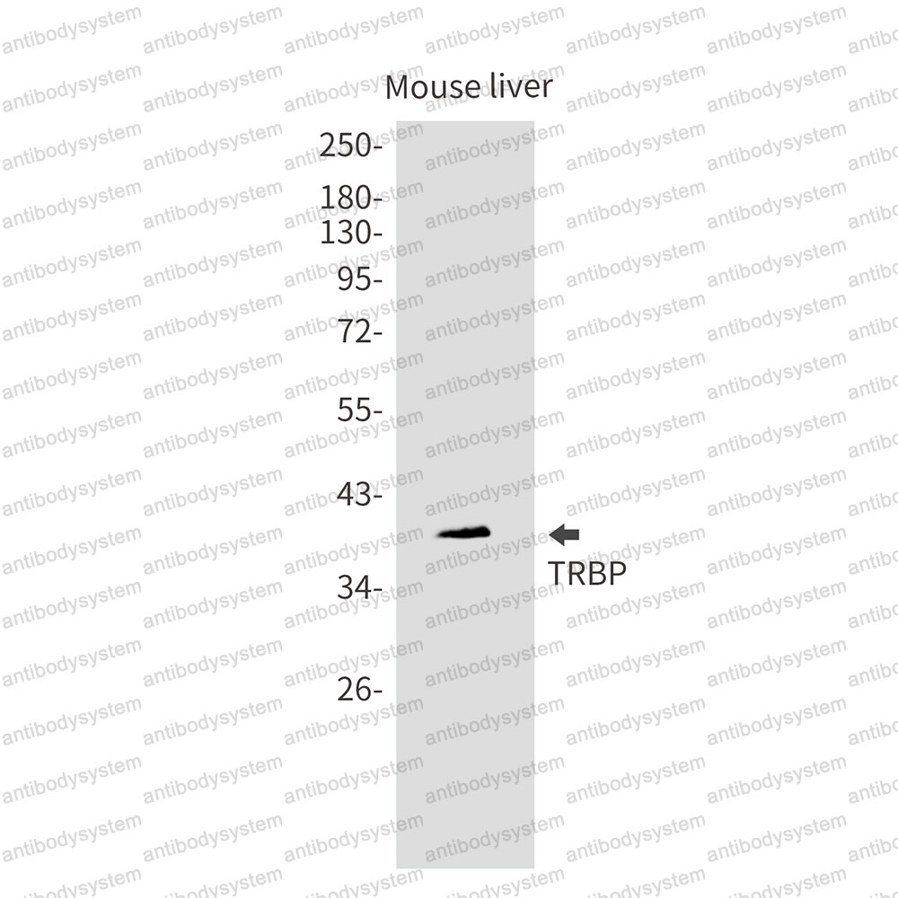Anti-TARBP2 Antibody (R2G45)