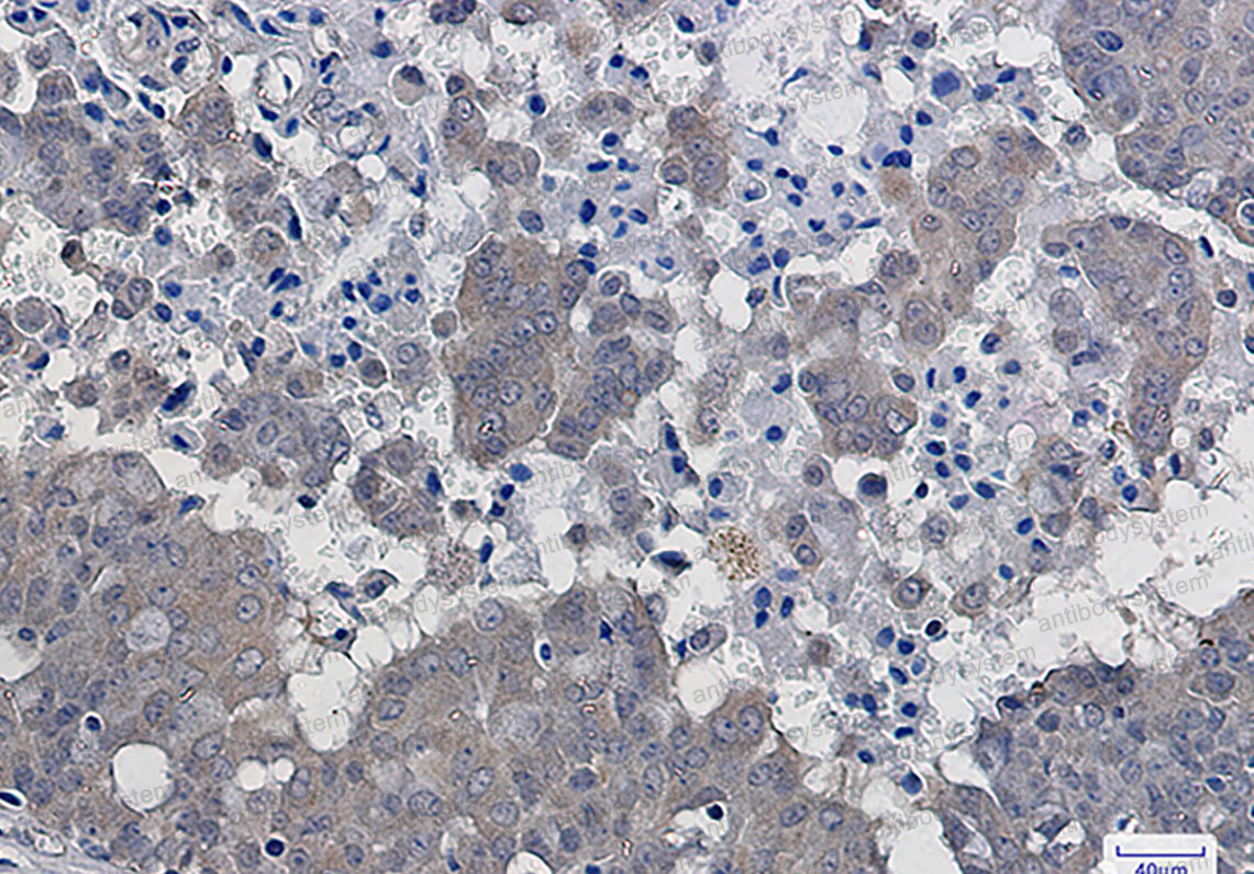 Anti-NFKBIB Antibody (R2G49)