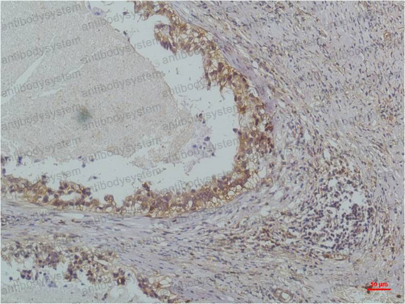 Anti-NFKBIB/IKB beta Antibody (R3T88)