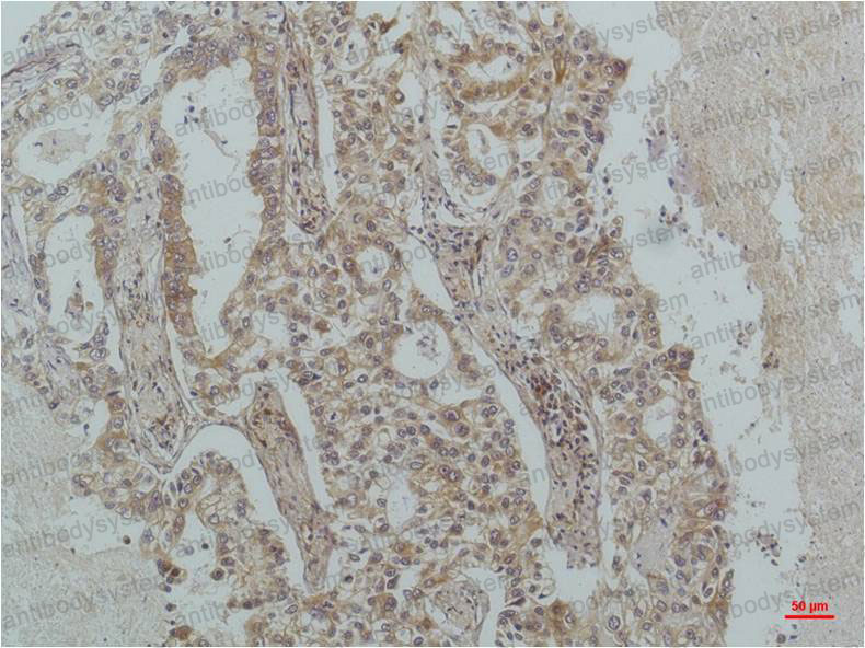 Anti-NFKBIB/IKB beta Antibody (R3T89)