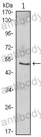 Anti-NFKBIB Antibody (R3T87)
