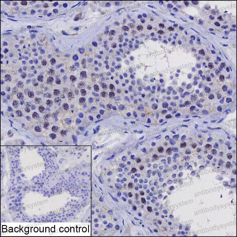 Anti-ZNF174 Antibody (R3T96)