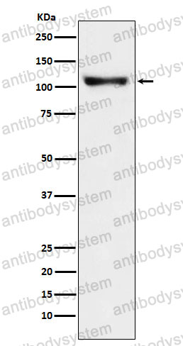 Anti-DLG2 Antibody (R2G50)
