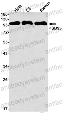 Anti-DLG2 Antibody (R2G51)