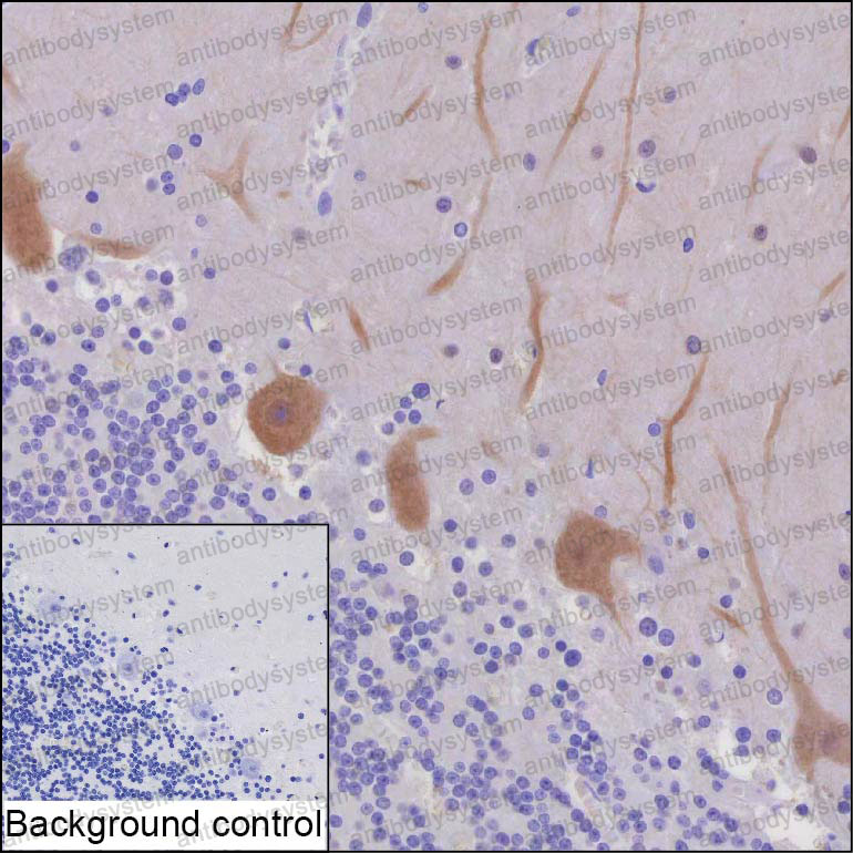 Anti-DLG2 Antibody (R3T97)