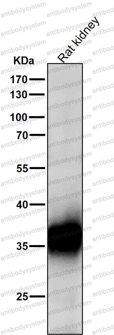 Anti-HuR/ELAVL1 Antibody (R2G52)