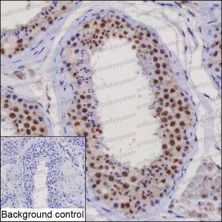 Anti-ELAVL1 Antibody (R3T98)