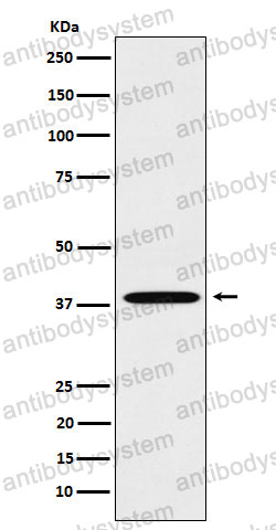 Anti-LTB4R Antibody (R2G53)