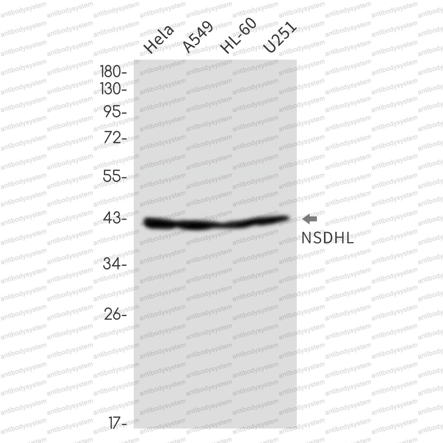 Anti-NSDHL Antibody (R2G56)
