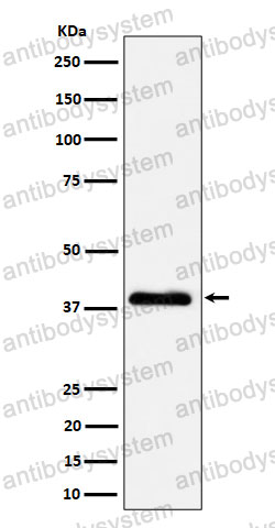 Anti-NSDHL Antibody (R2G54)