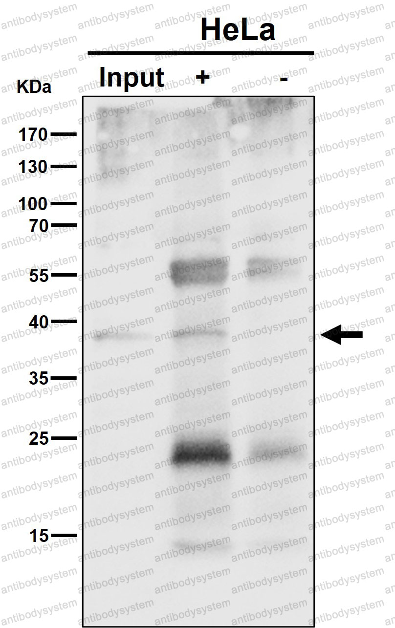 Anti-NSDHL Antibody (R2G55)