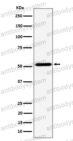 Anti-NPY5R Antibody (R2G58)