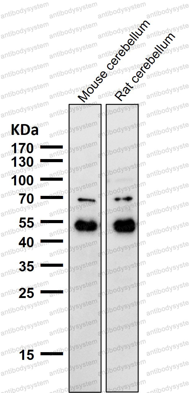 Anti-NEUROD2 Antibody (R2G61)
