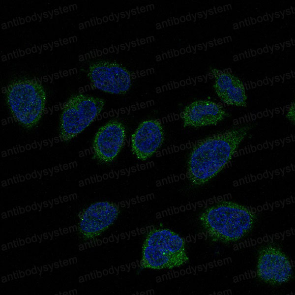 Anti-SMAD2 Antibody (R1A46)