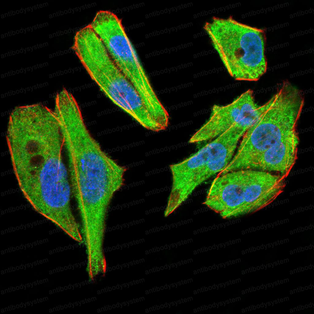 Anti-TBCC Antibody (R3U07)