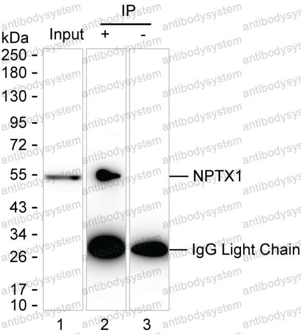 Anti-NPTX1 Antibody (R3U08)