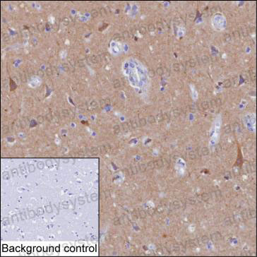 Anti-NPTX1 Antibody (R3U09)