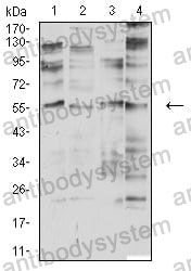 Anti-CHRNA2 Antibody (R3U10)