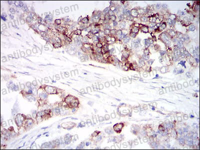 Anti-IGFBP7 Antibody (R3U24)