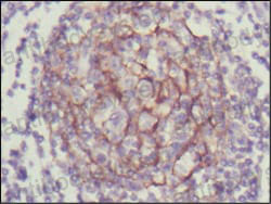 Anti-NTRK3/TrkC Antibody (R3U25)