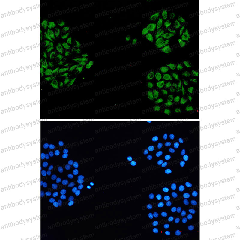 Anti-INA Antibody (R2G89)