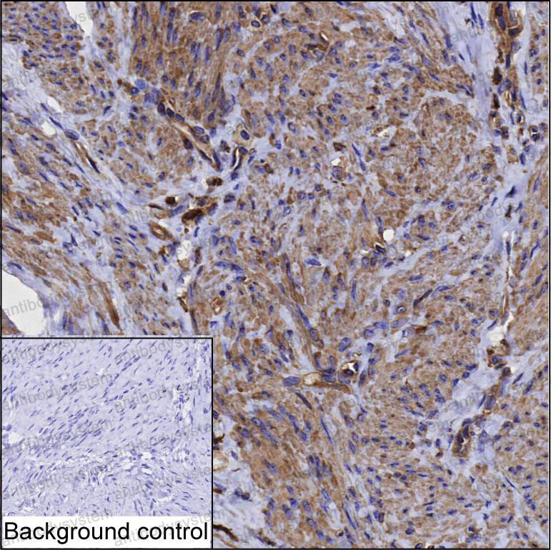 Anti-LAMA4 Antibody (R3U27)