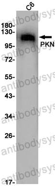 Anti-PKN1 Antibody (R2G90)