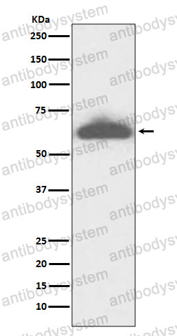 Anti-RPE65 Antibody (R2G92)