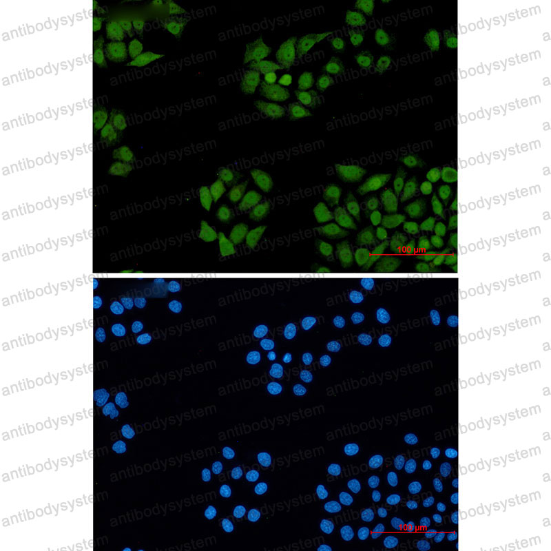 Anti-DDB1 Antibody (R2G94)