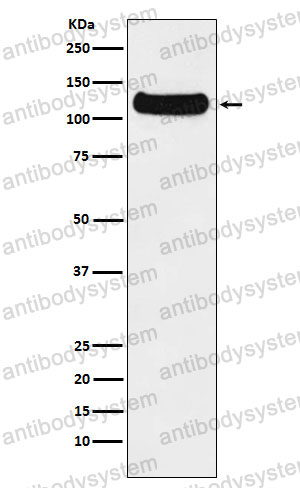 Anti-DDB1 Antibody (R2G93)