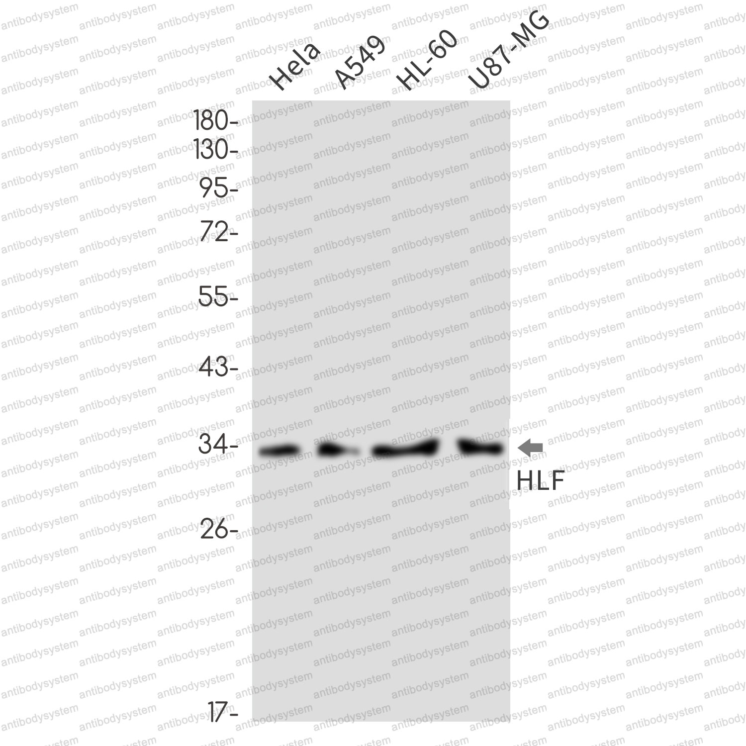 Anti-HLF Antibody (R2G95)