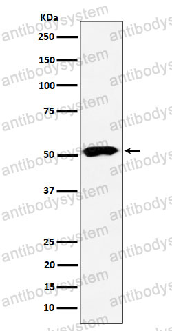 Western blot for Anti-PPP2R5E Antibody (R2G96) ?>