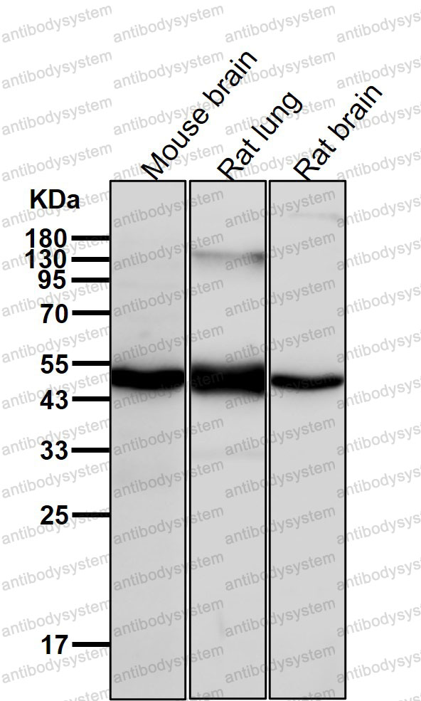 Western blot for Anti-PPP2R5E Antibody (R2G96) ?>