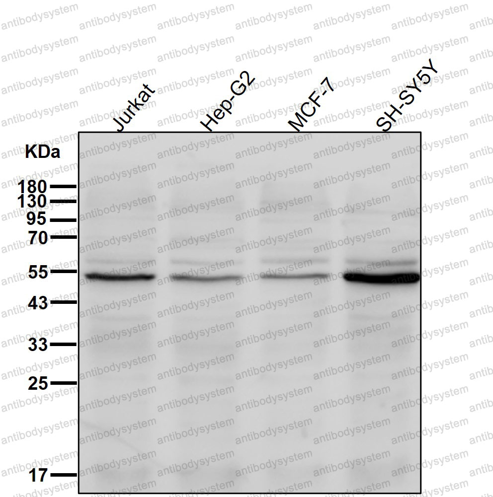 Western blot for Anti-PPP2R5E Antibody (R2G96) ?>