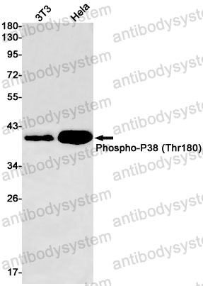 Anti-Phospho-MAPK14/p38 (Thr180) Antibody (R2G99)