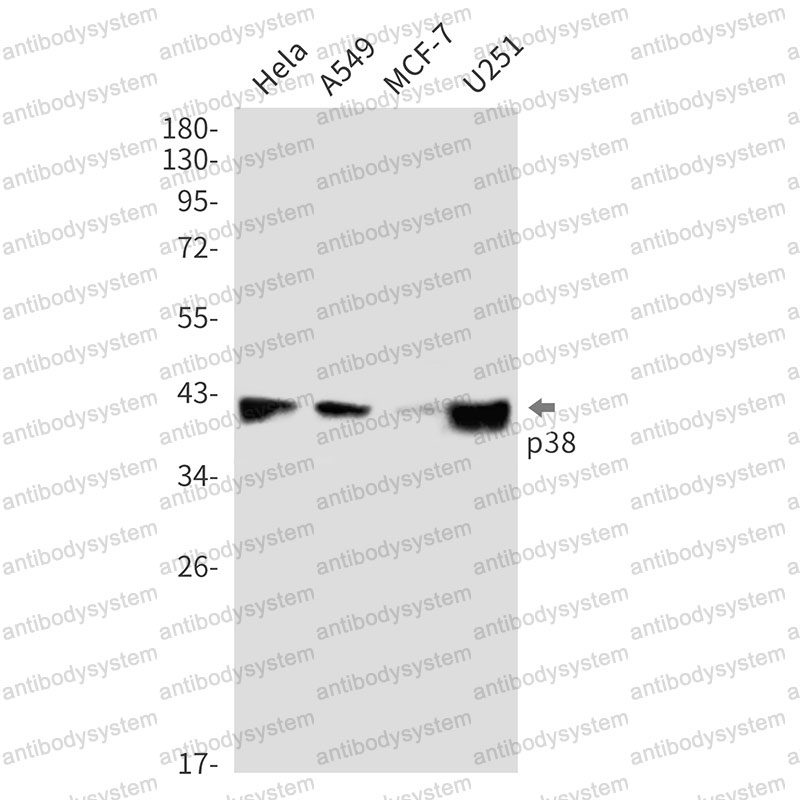Anti-MAPK14/p38 Antibody (R2H02)