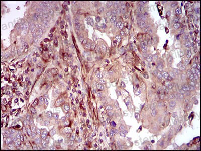 Anti-MAPK14 Antibody (R3U33)