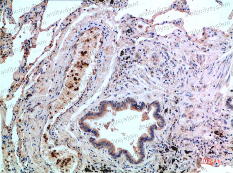 Anti-MAPK14/p38 Antibody (R3U34)