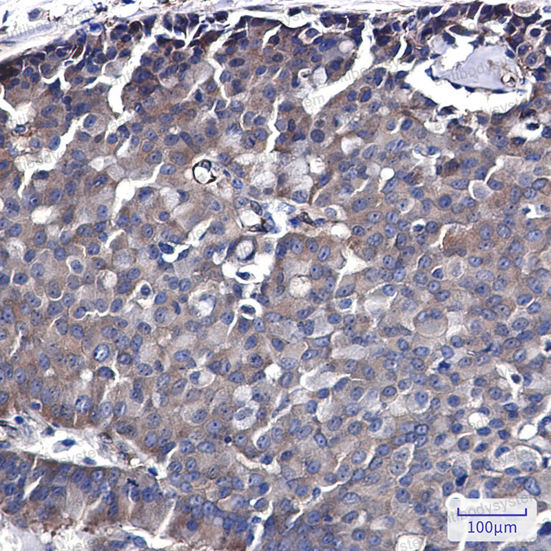 Anti-CDC37 Antibody (R2H05)