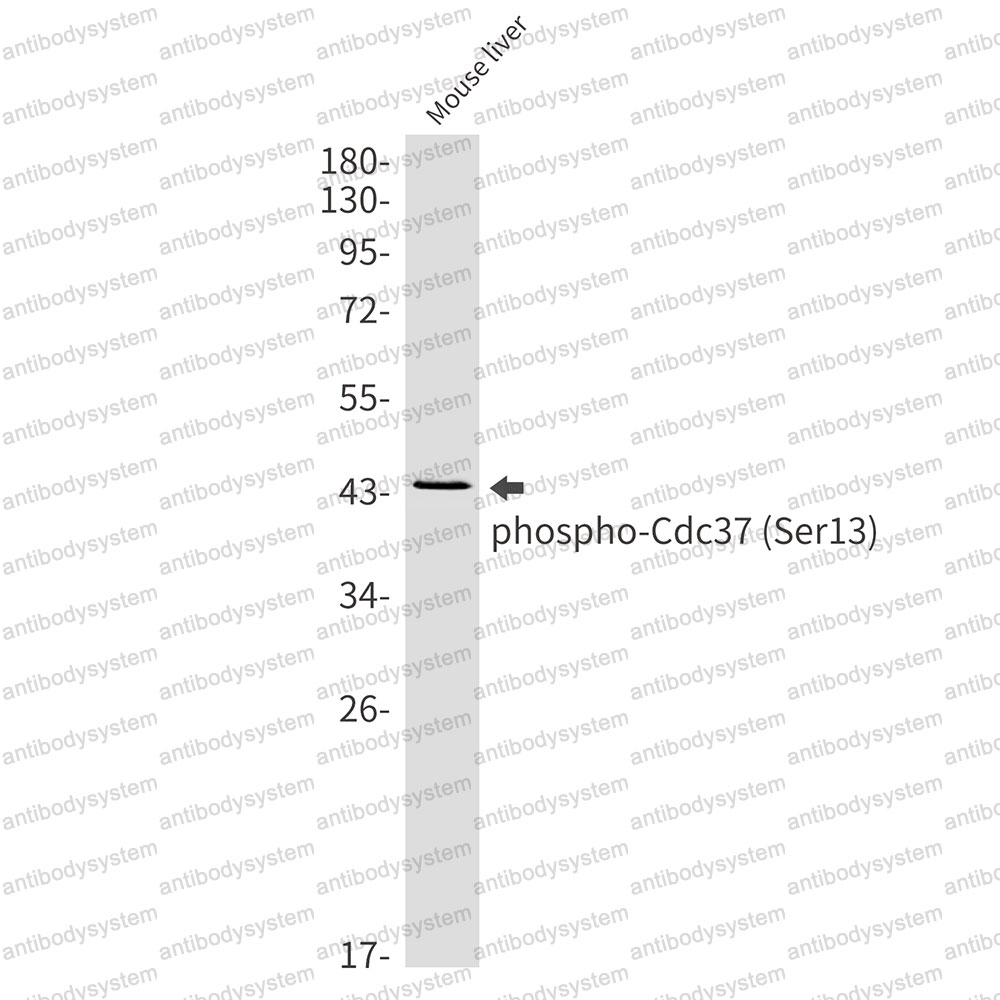 Anti-Phospho-CDC37 (Ser13) Antibody (R2H03)