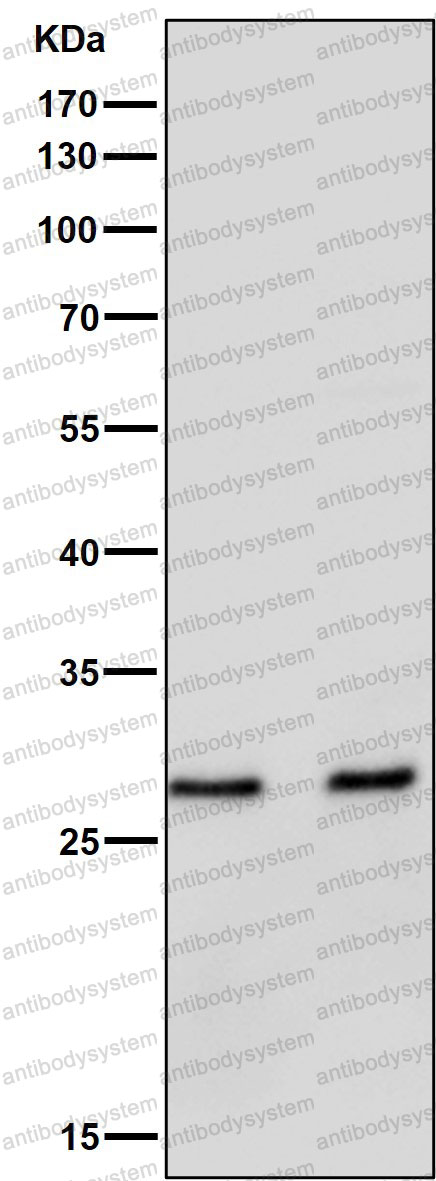 Anti-BCL2A1 Antibody (R2H06)