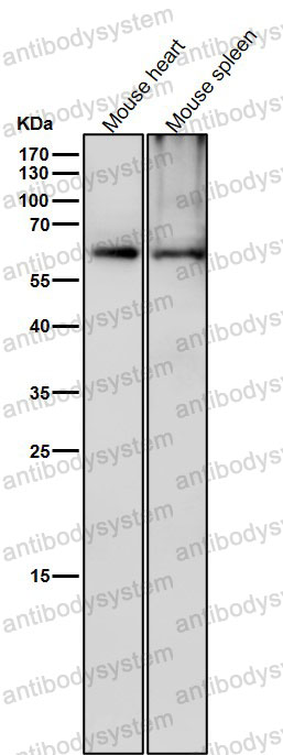 Anti-Phospho-CRMP2/DPYSL2 (T514) Antibody (R2H08)