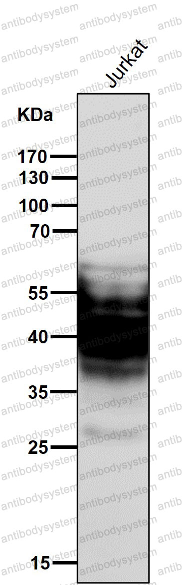 Anti-SYPL1 Antibody (R2H09)