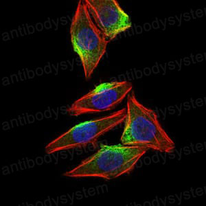 Anti-CAMK4 Antibody (R3U38)