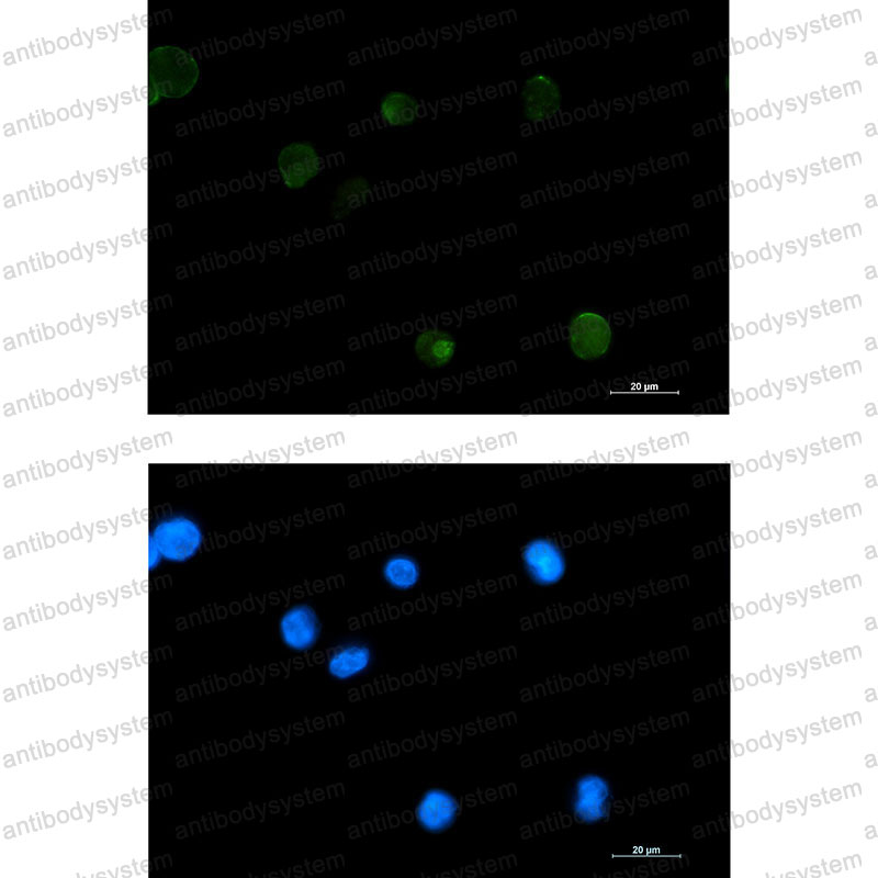 Anti-ECM1 Antibody (R2H16)
