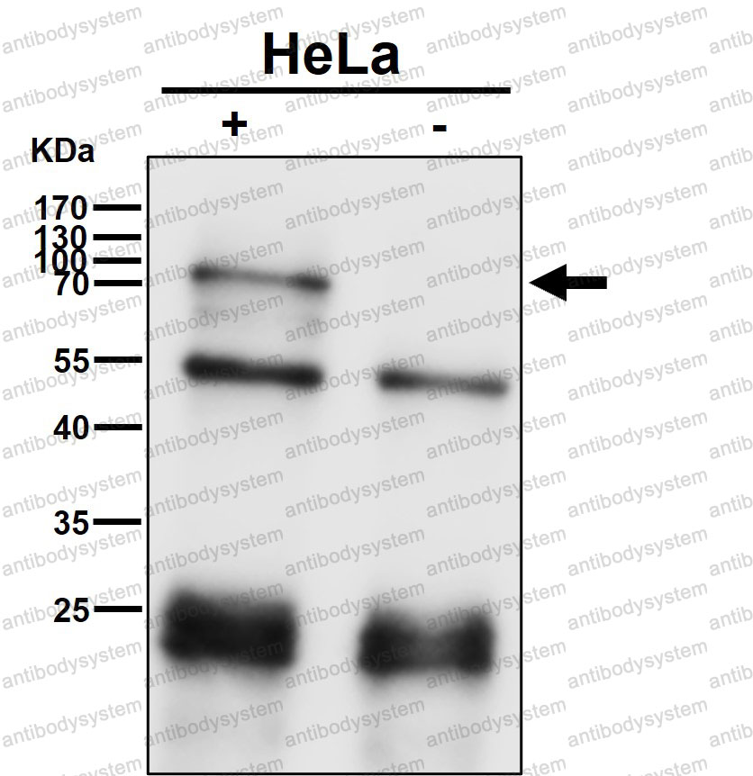 Anti-ECM1 Antibody (R2H15)