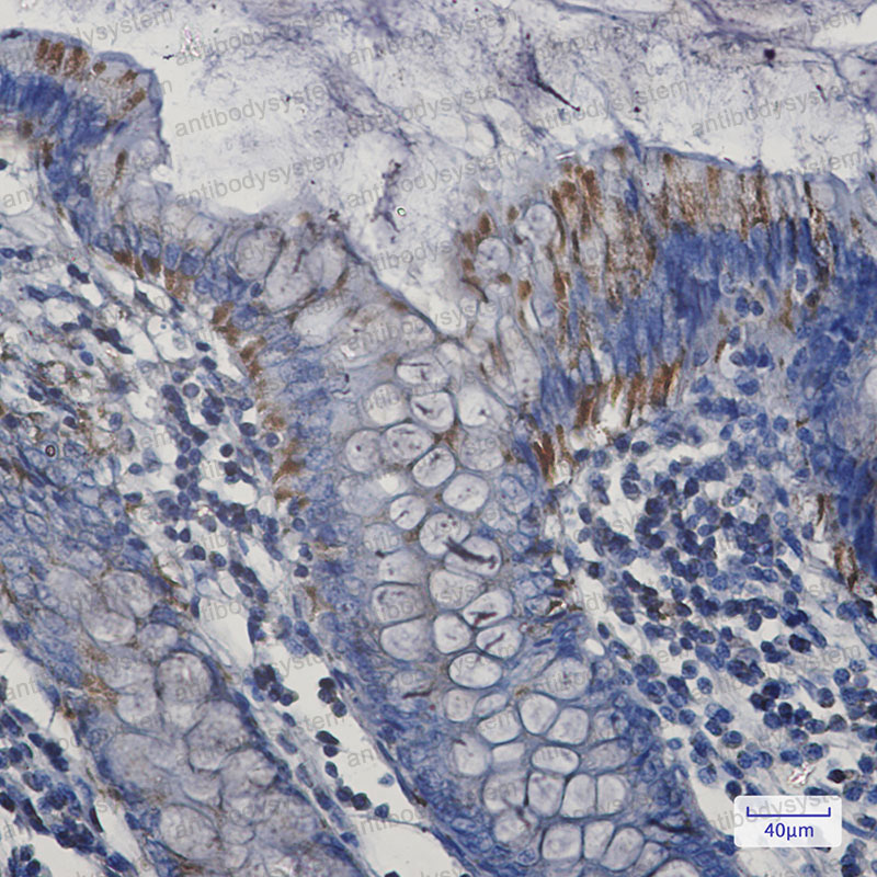Anti-BAK1 Antibody (R2H17)