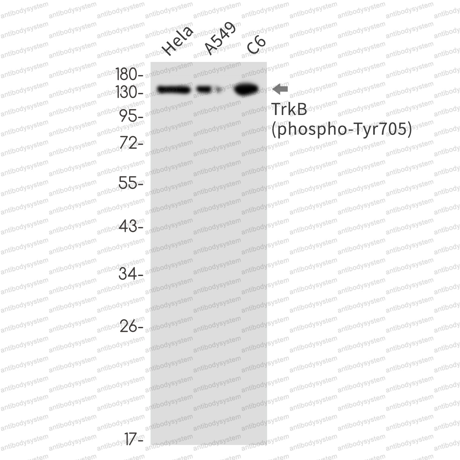 Anti-Phospho-TrkB /NTRK2 (Tyr705) Antibody (R2H19)