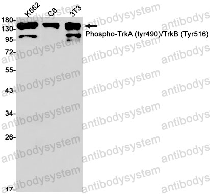 Anti-Phospho-TrkA/B (Tyr490/Tyr516) Antibody (R2H20)