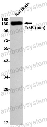 Anti-TrkB /NTRK2 Antibody (R2H21)